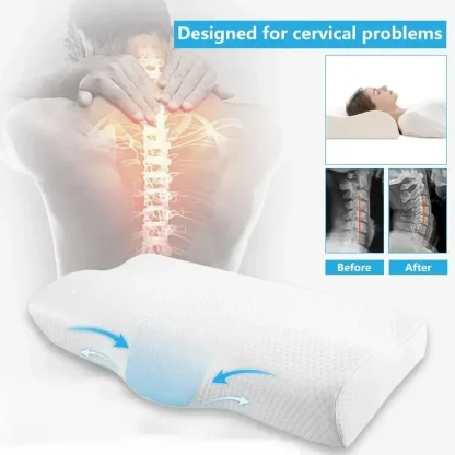 Butterfly Shaped Pillow for Neck Protection - Image 2